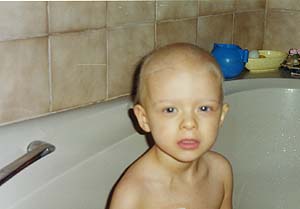 Aplasie f�brile, d�cembre 98